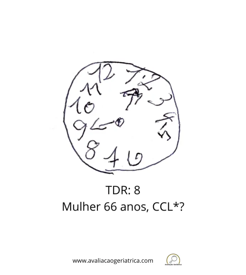 Exemplo teste do desenho do relógio: 8 pontos (Sunderland): Mulher 66 anos - CCL?